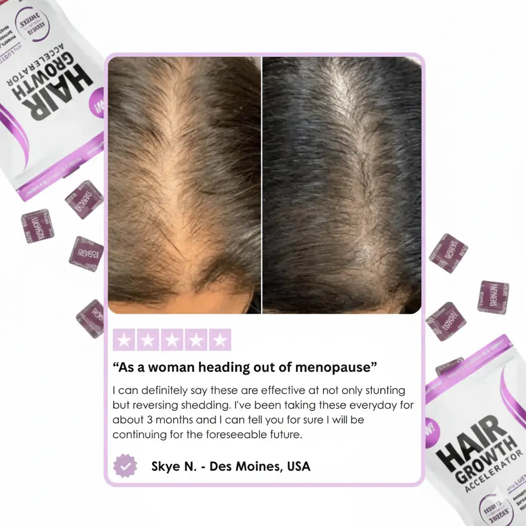 Hair Growth Accelerator Soft Chews™
